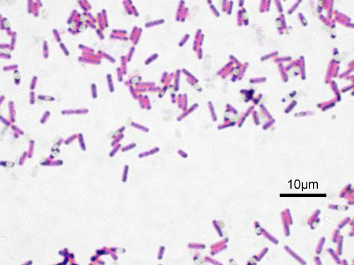 Bacillus subtilis Gram.jpg