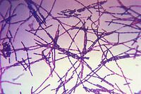 Bacillus anthracis Gram.jpg